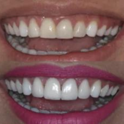 Dentistica - Ortex (3)